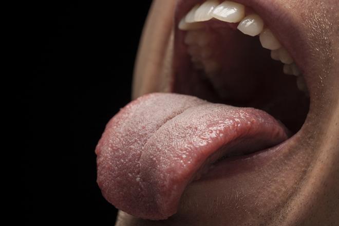 El color de tu lengua puede avisarte si tienes cáncer o diabetes, según Harvard