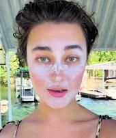 Una chica usa la crema de sol para lograr un efecto «sun kiss», quemarse la punta de la nariz y los pómulos para realzar el color. | TikTok