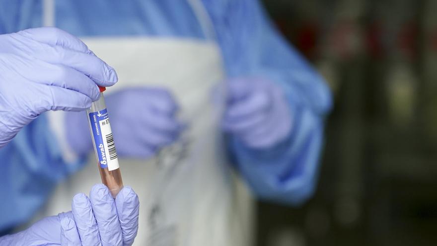 Canarias cierra la semana con 10 nuevos fallecidos y 2.511 contagios de coronavirus