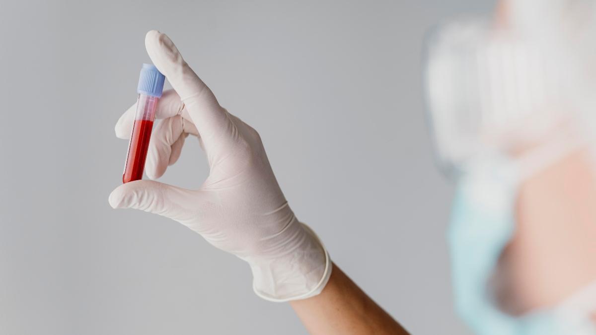 La mielofibrosis es un tipo poco frecuente de cáncer de la sangre que afecta a la médula ósea