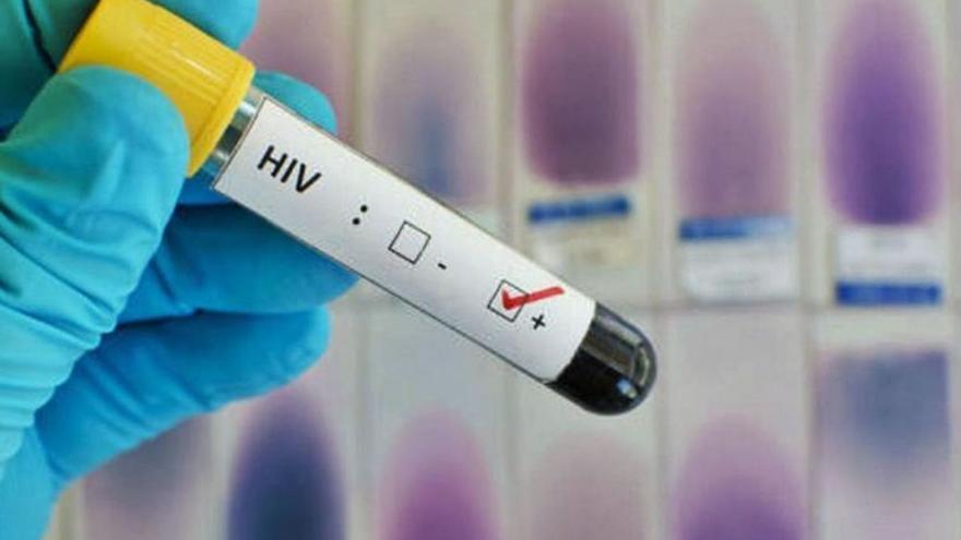 Desde el inicio de 2022, el complejo ha diagnosticado un total de 19 casos positivos de VIH desde el servicio de Urgencias. | L.O