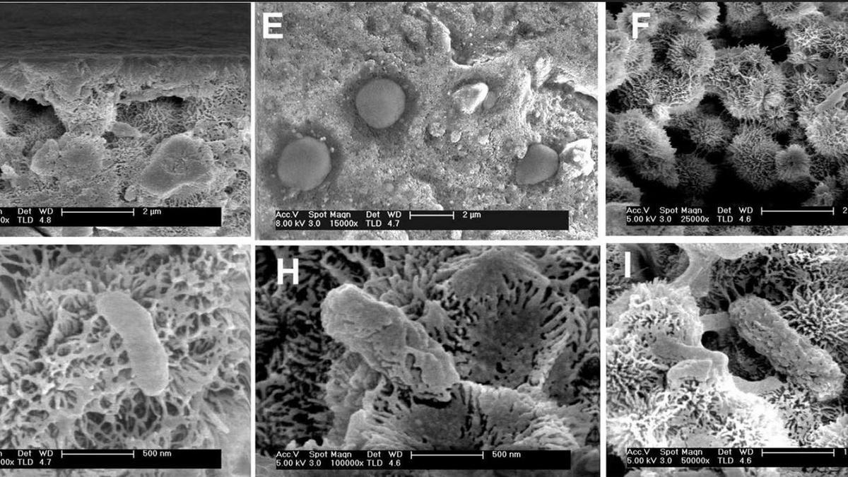 Microorganismos hallados en la zona