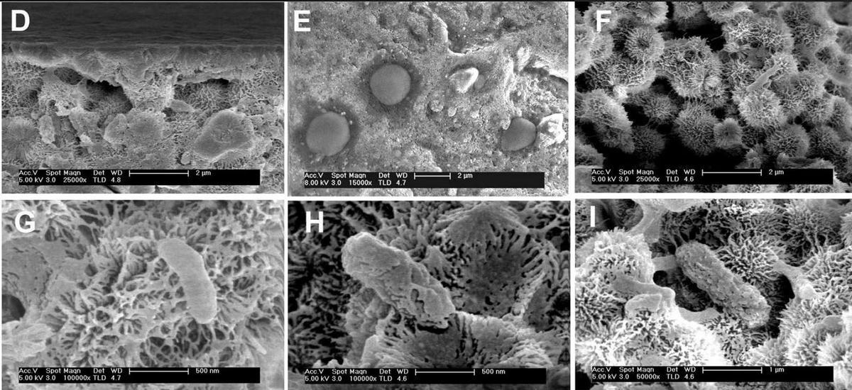 Microorganismos hallados en la zona