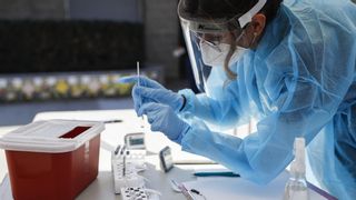 OMS activa su máximo nivel de alerta global ante el brote de viruela del mono