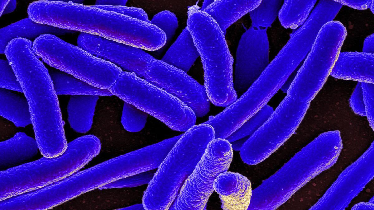 Micrografía electrónica de barrido coloreada de Escherichia coli