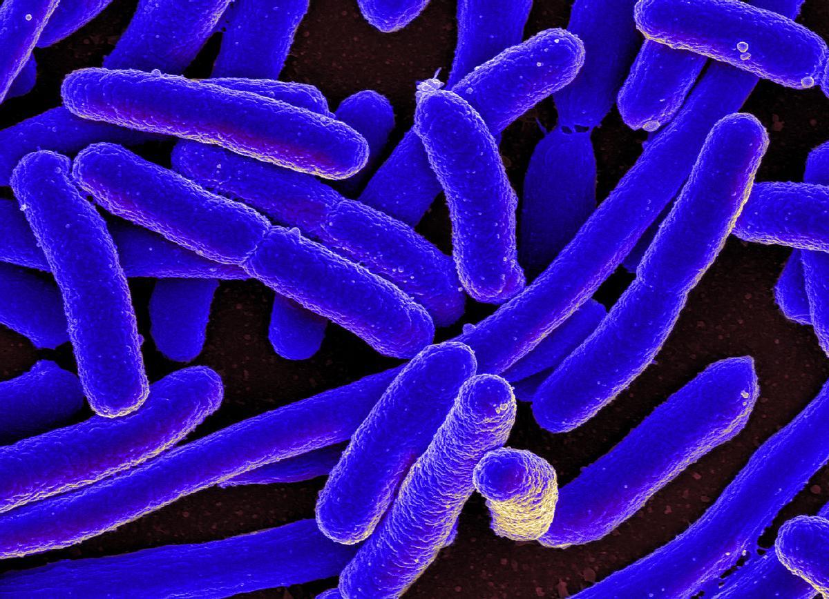 Micrografía electrónica de barrido coloreada de Escherichia coli