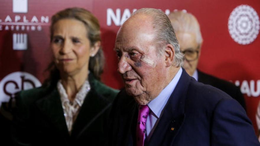 Juan Carlos I reaparece con un ojo morado