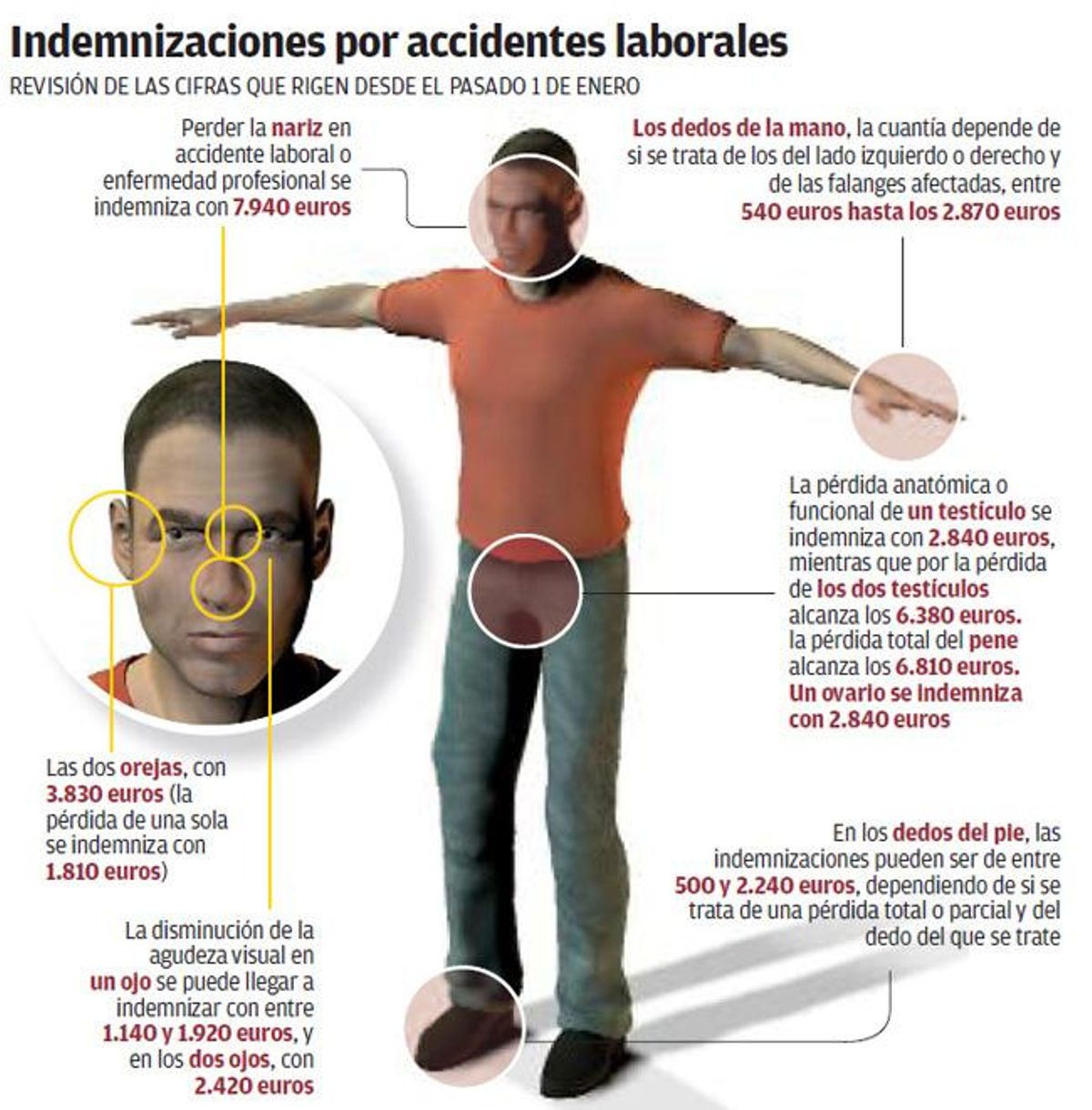 Accidente laboral: Lo que vale cada parte de tu cuerpo