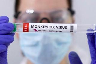 La OMS mantiene la alerta por la viruela del mono