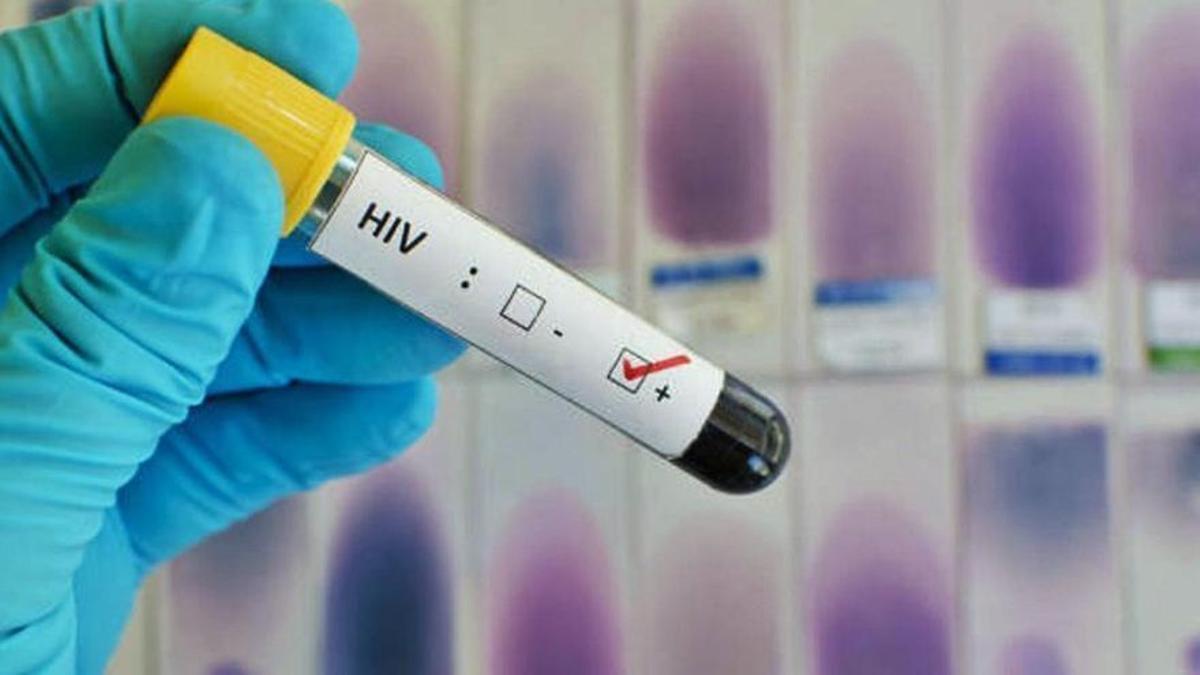 Test positivo del VIH