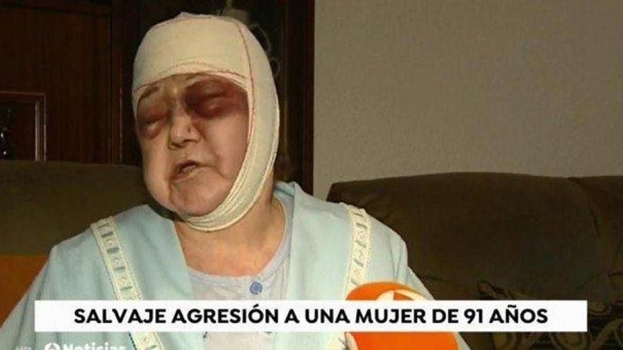 Brutal agresión a una mujer de 91 años en Barcelona