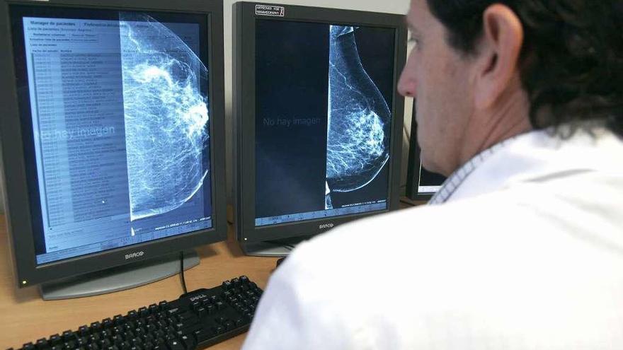 El cáncer causa 24 muertes al día en Galicia