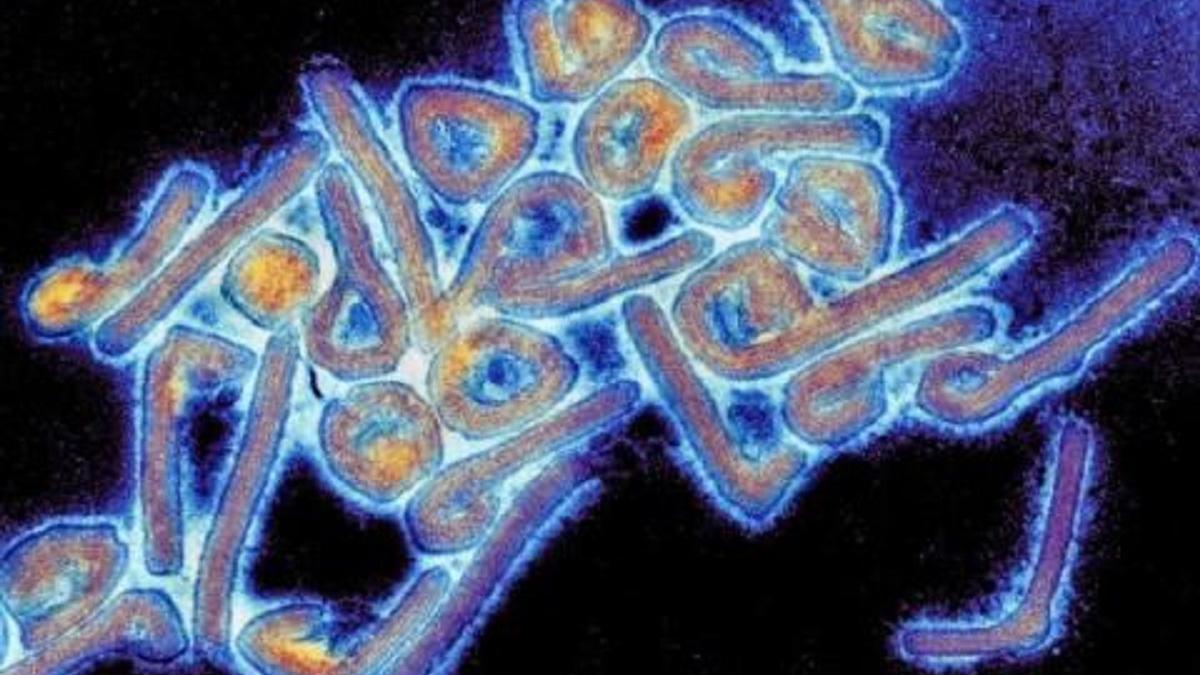 ¿Qué es el virus de Marburgo que ha desatado un brote epidémico en África?