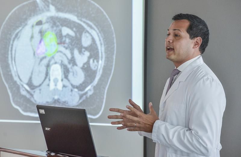 02/05/2018 LAS PALMAS DE GRAN CANARIA.  presentación de los detalles en la técnica de radiocirugía para tratar tumores de páncreas guiada por GPS en Hospital Doctor Negrín. FOTO; J. PÉREZ CURBELO  | 02/05/2018 | Fotógrafo: José Pérez Curbelo