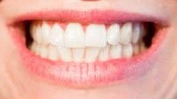 Dentadura sonriente