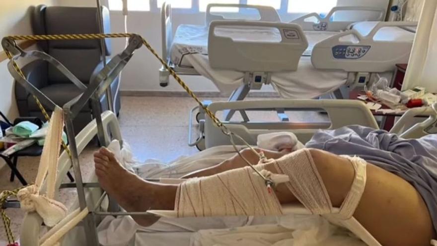 Tardan tres días en escayolar a un anciano con la pierna rota en el Hospital General de Castellón