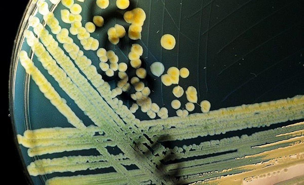 Una mostra d’una colònia del bacteri Coli exposada aquest dilluns pel Consell Estatal de Salut a Hanover, Alemanya. Un grup de científics estan investigant el bacteri E. Coli després que nombroses persones hagin estat infectades a Alemanya. Aquest bacteri produeix rampes estomacals i diarrea. A més, pot conduir a anèmia i dany renal.