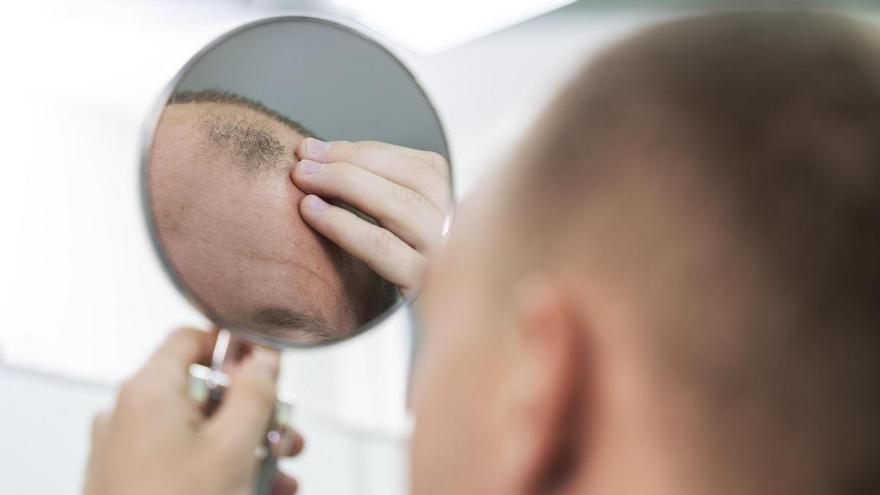 ¿Se me está cayendo demasiado el pelo? Descubre si te estás quedando calvo y cuándo ir al médico