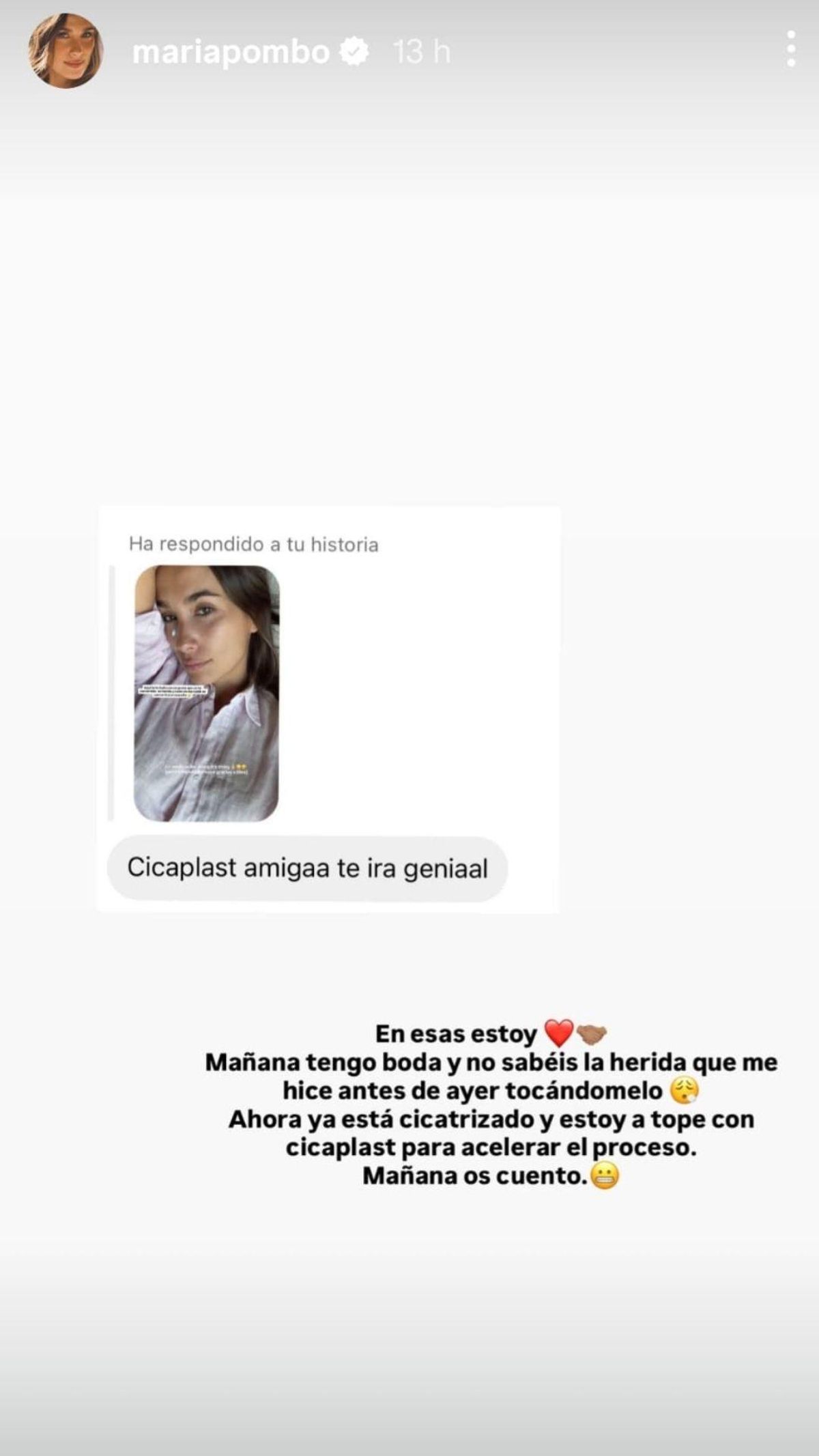 María Pombo comparte la crema que usa para fomentar la cicatrización en su rostro