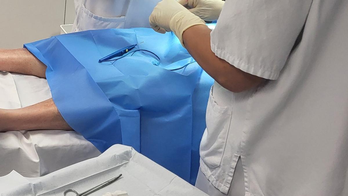 Operació de fimosi amb la nova tècnica que utilitza l'Hospital de Figueres