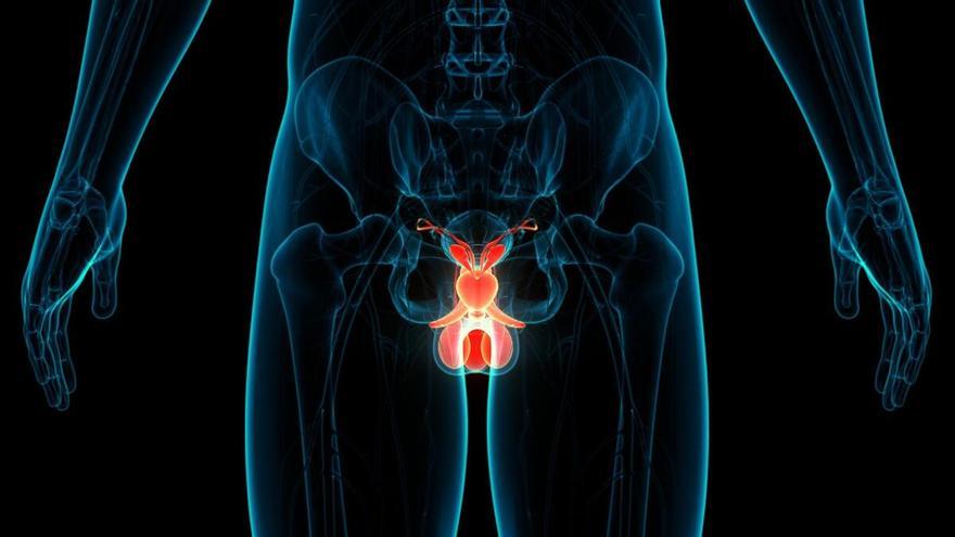 Próstata: Cómo descubrir que empiezan los problemas y cómo aliviar los síntomas