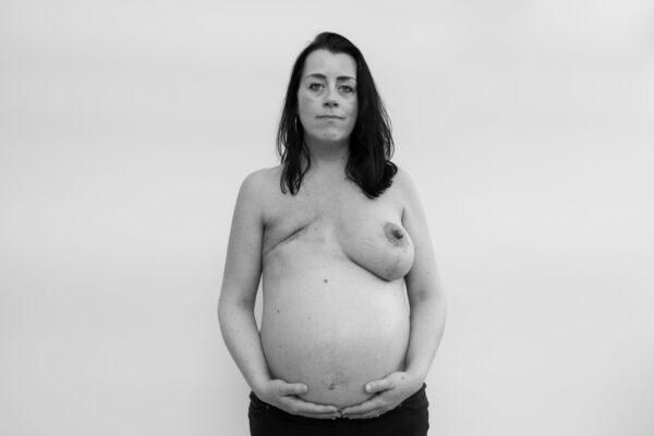O cancro de mama, nunha mostra sen estereotipos e con perspectiva de xénero na Coruña: "Son fotos moi duras, pero moi necesarias"