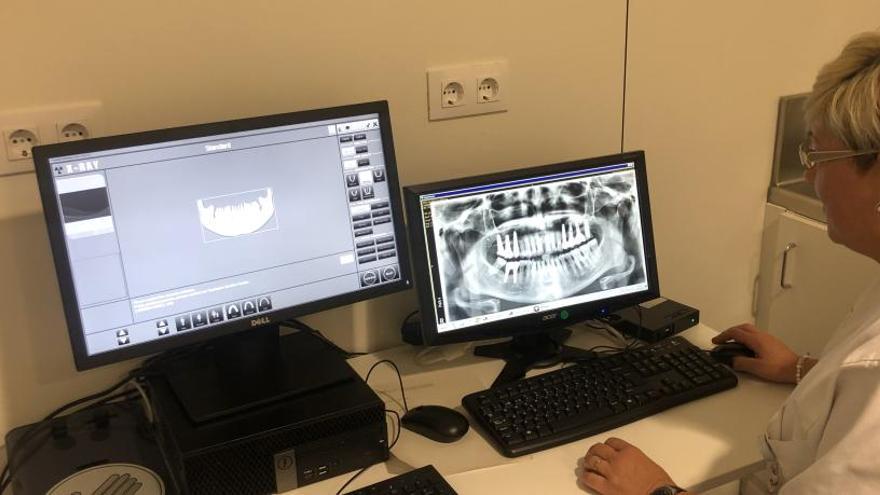 La nova tècnica de radiografia bucodental.