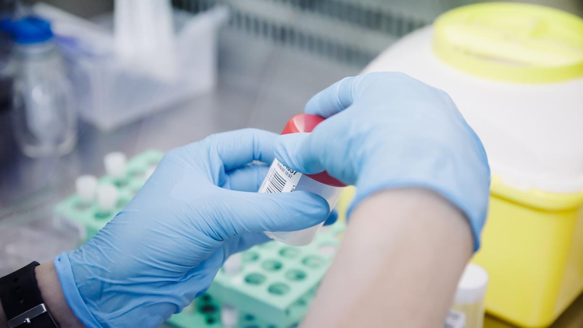 Eine Krankenschwester führt im Krankenhaus Ramon y Cajal in Madrid einen PCR-Test zur Erkennung des Affenpockenvirus durch. Madrid hat am Montag mit der Durchführung von PCR- und Genomsequenzierungstests auf Affenpocken in fünf öffentlichen Krankenhäusern der Region begonnen.