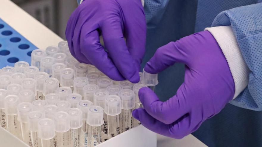 Sanidad crea un autotest para detectar el coronavirus