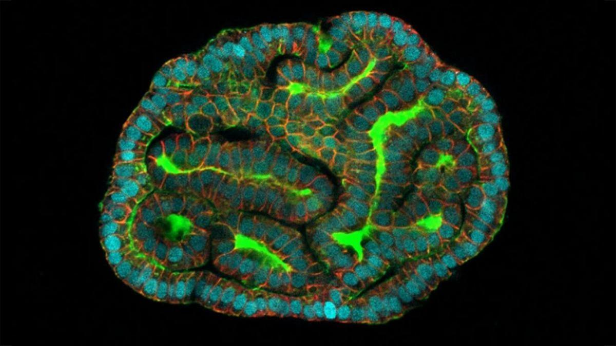 Un organoide renal elaborado a partir de células amnióticas.