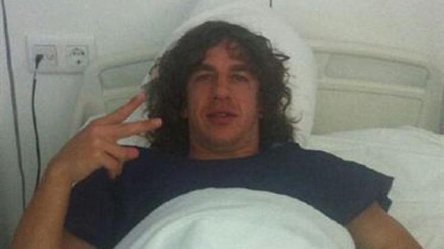 Carles Puyol estará entre un mes y medio y dos de baja