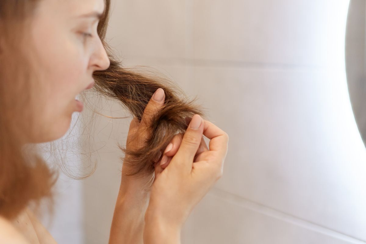 Estos son los primeros síntomas de la calvicie que afecta a las mujeres