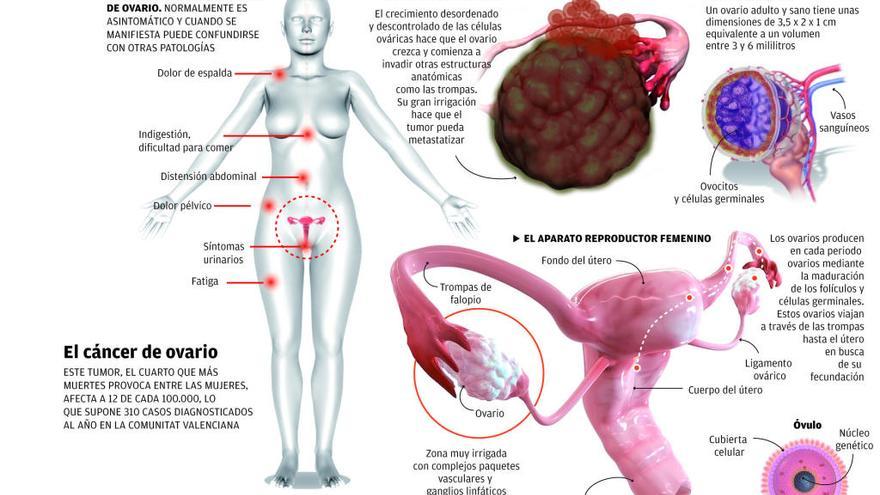 cancer colon y ovario oxiurose nome da doenca