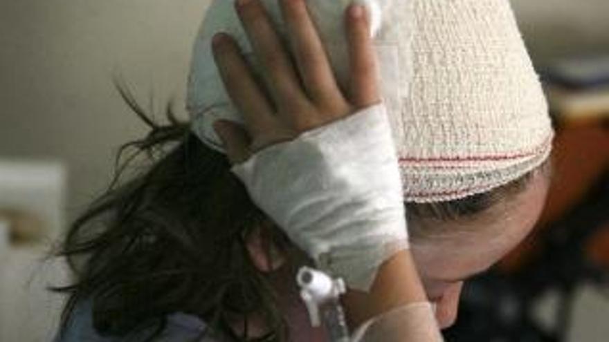 Brutal ataque de dos rottweiler a una niña de 6 años