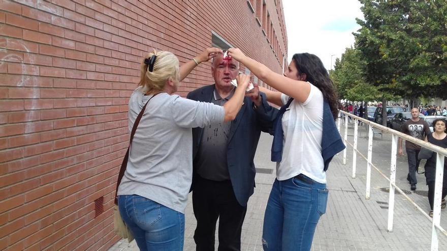 Una de les víctimes de la càrrega policial a l&#039;IES Quercus de Sant Joan