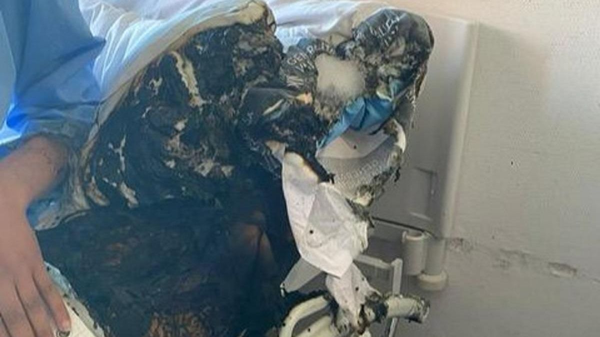 Colchón quemado en la planta de Psiquiatría del Clínico de València
