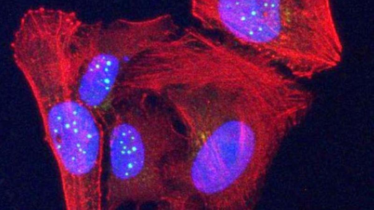 La proteína telomérica VR recién descubierta (esferas verdes) se acumula en núcleos (óvalos azules) en células cancerosas de osteosarcoma humano teñidas en rojo.