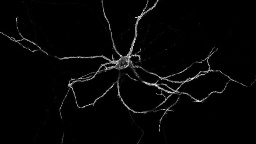 Un zoom sobre las neuronas descubre una cadena cerebral de luces