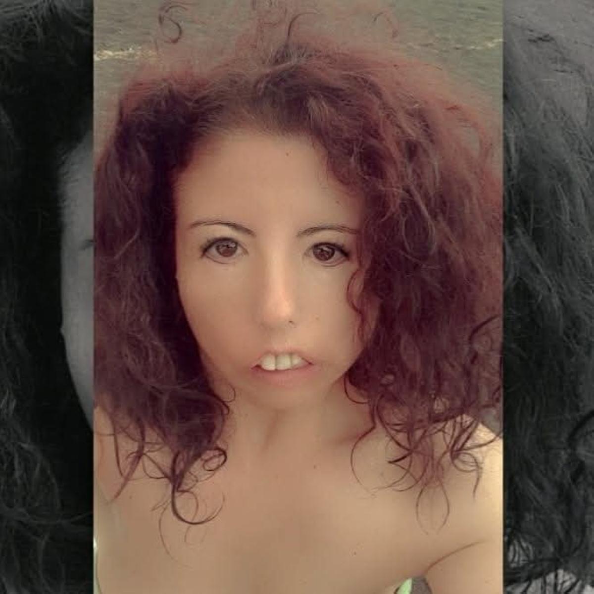 Sonia Rodríguez, afectada del Síndrome de Moebius