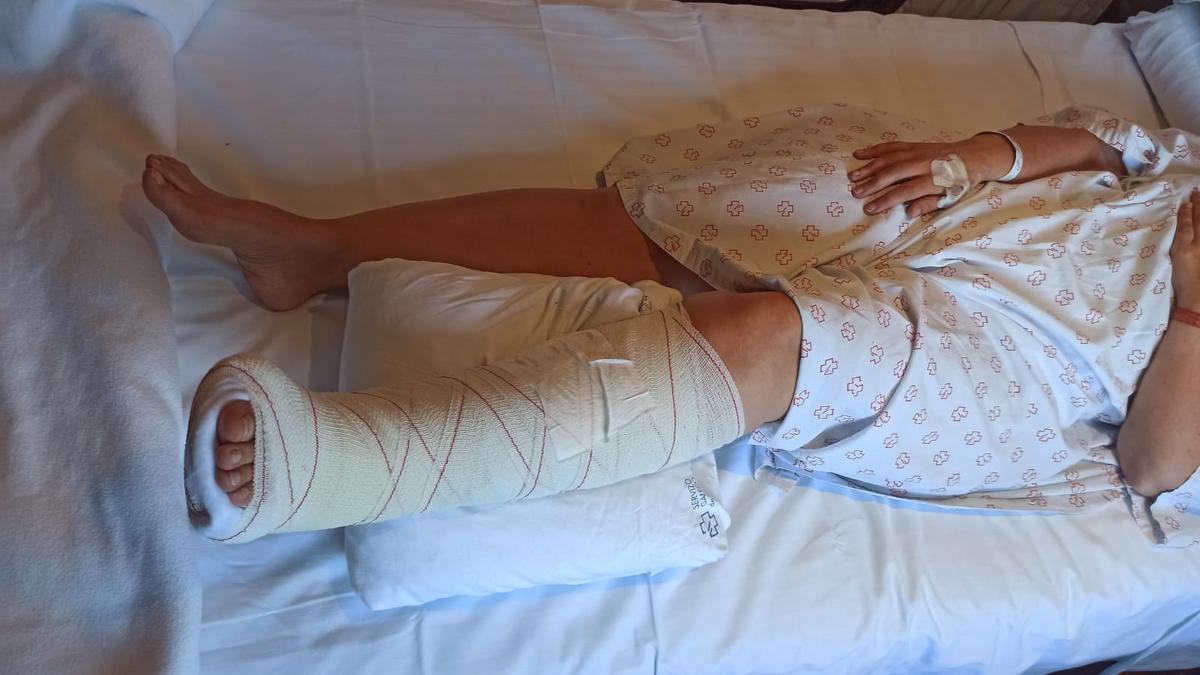 La vecina de Bueu, ayer en Montecelo, con la pierna y el pie inmovilizado. Hoy será operada de una triple fractura de tobillo.
