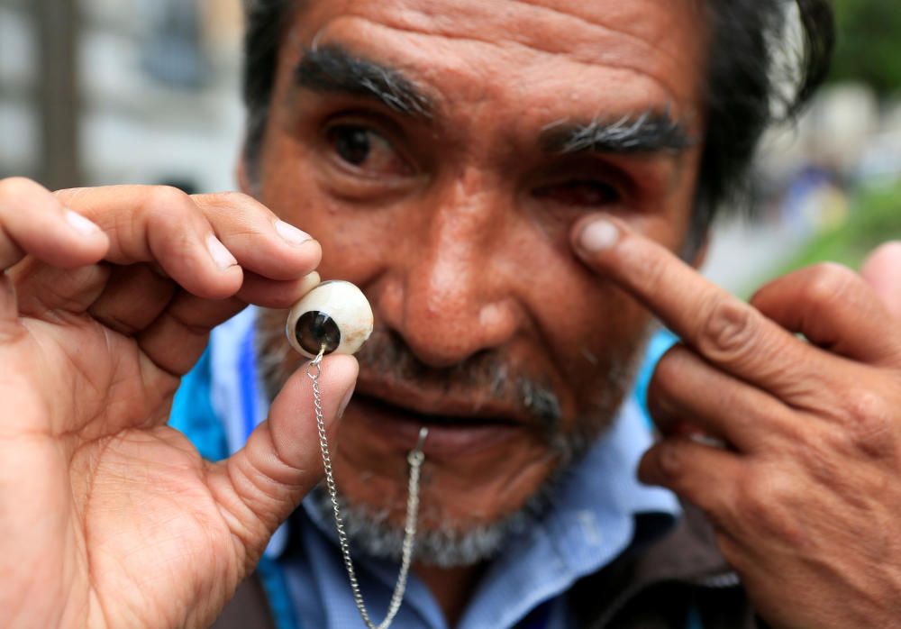 Edwin Morales, que en la imagen enseña su ojo protésico, es uno de los líderes de la protesta en La Paz, Bolivia, para que Evo Morales suba la pensión mensual por invalidez.