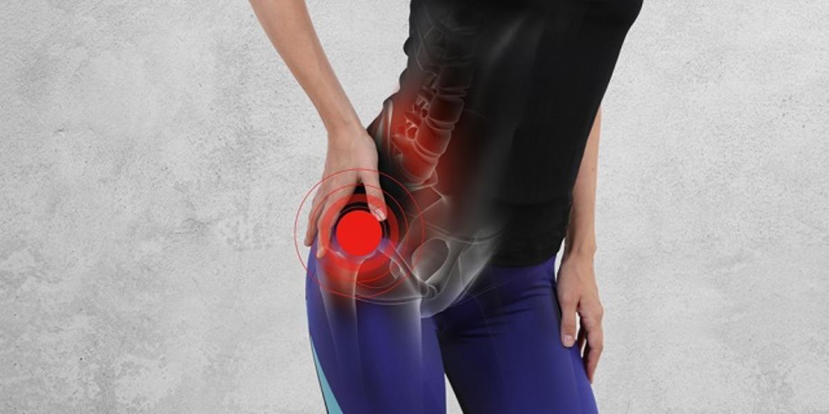 La artrosis de cadera es uno de los cinco tipos más abundantes