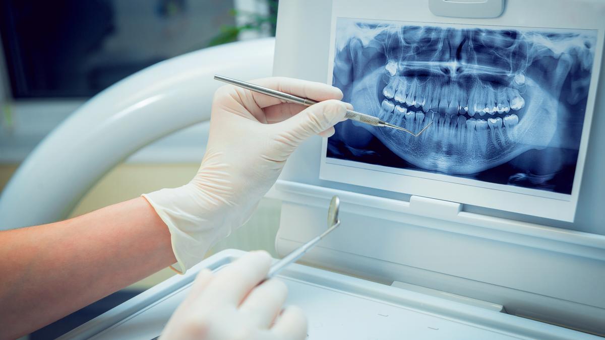 Los implantes dentales nos ayudan a recuperar la función y estética de la boca.