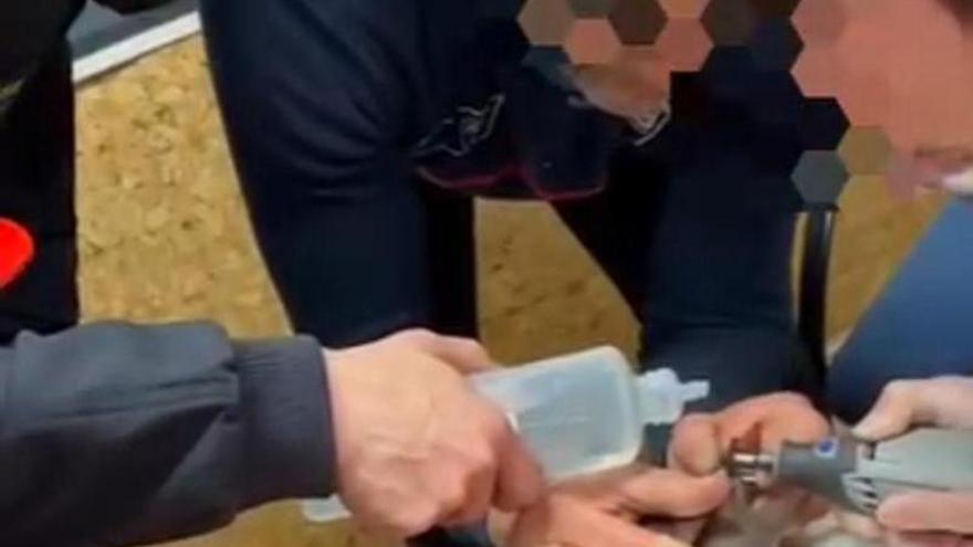 Sucesos Murcia | Movilizan a los bomberos para sacar un anillo a un hombre ebrio en la comisaría de Mazarrón: «No tenía circulación sanguínea»