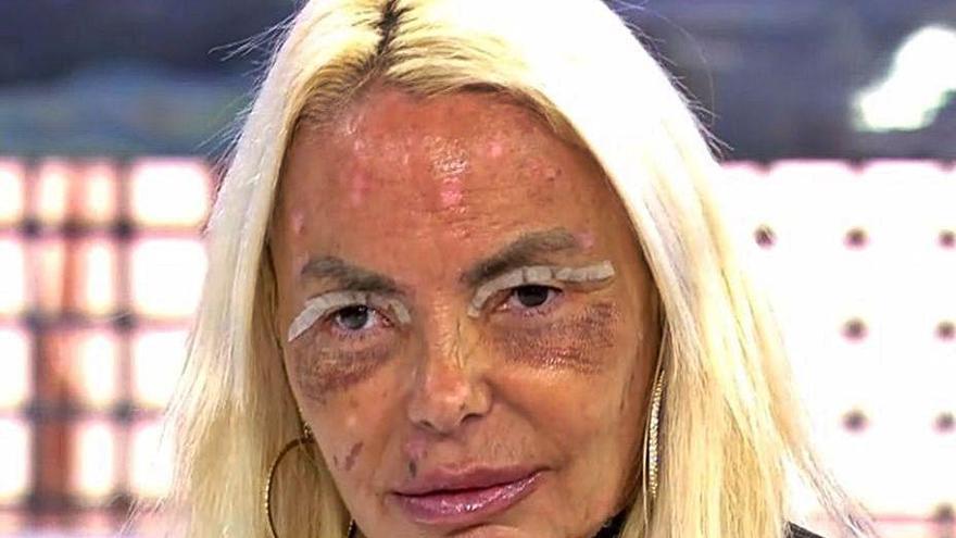 Leticia Sabater, publicitando su blefaroplastia.