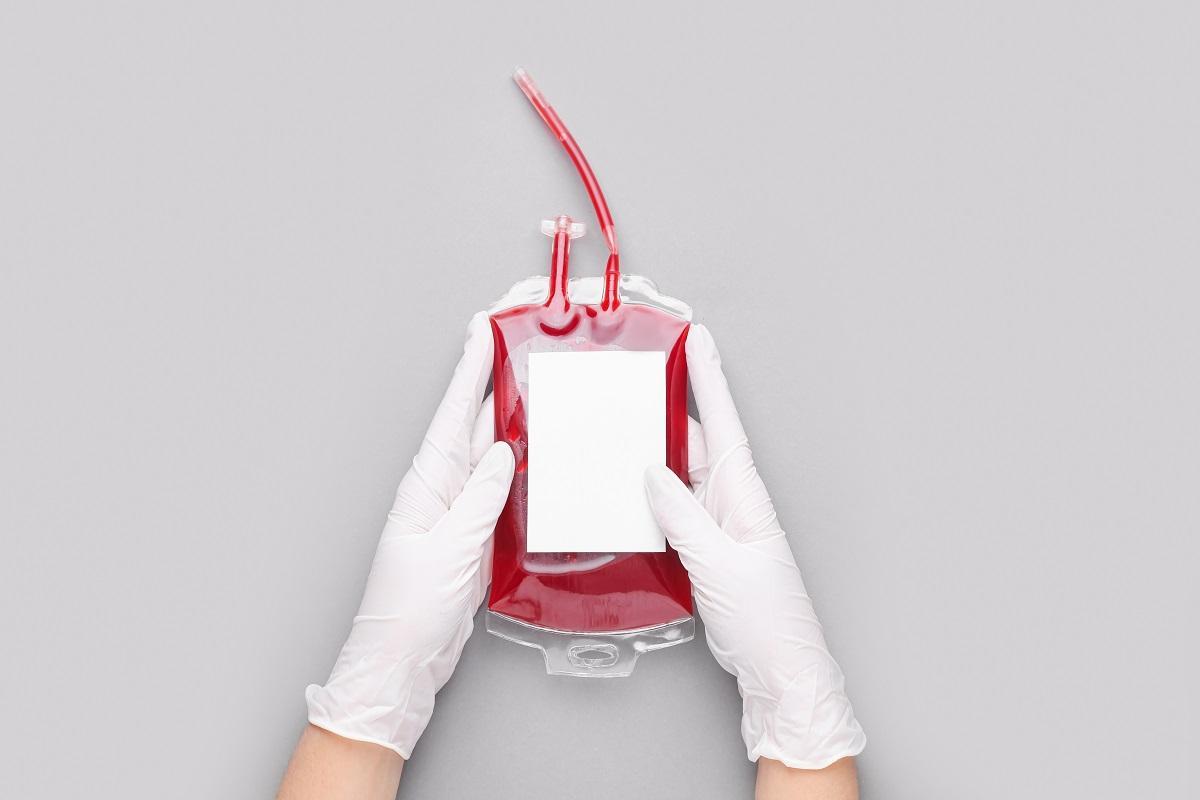 ¿Qué es la plasmaféresis y por qué resulta esencial para la sanidad?