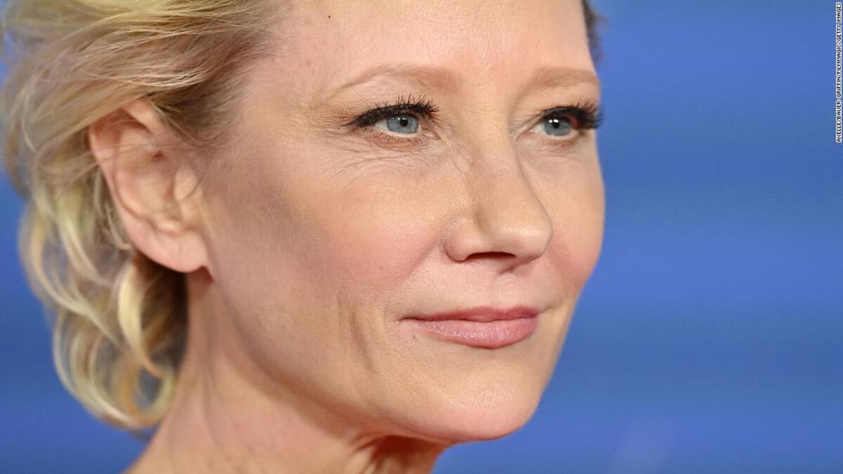 La actriz Anne Heche, en estado crítico tras chocar su coche contra una casa