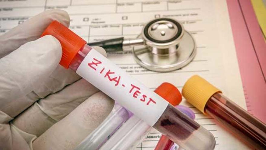 Un test del virus del zika.