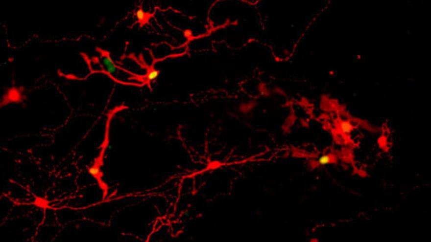 A un paso de probar en humanos retinas cultivadas en laboratorio