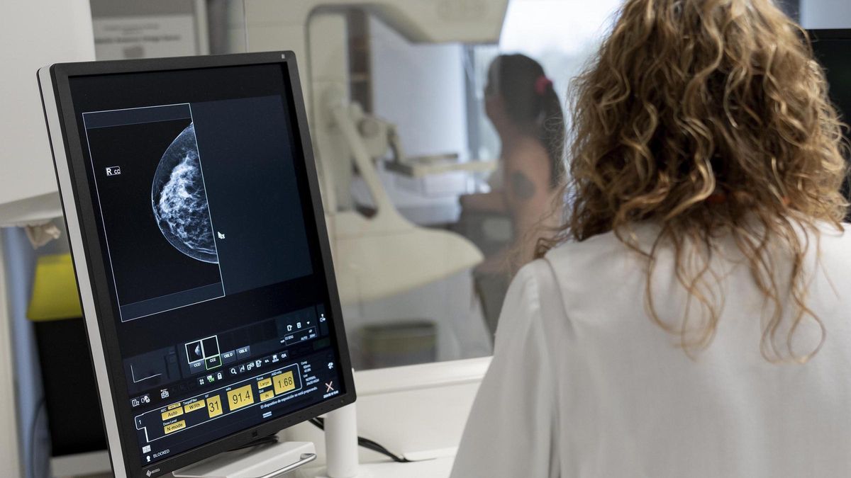Un fármaco que frena el cáncer de mama metastásico demuestra ser efectivo también en fases más tempranas
